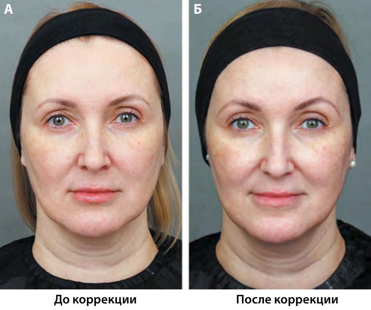 Рис. 9. Пациентка, 45 лет